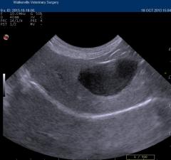 micki's liver ultrasound