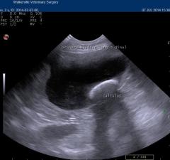 ultrasound bladder stone