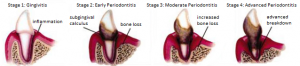 dog dental decay