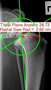 TPLO surgery measurement