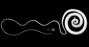 trichuris whipworm