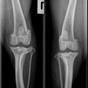 dog knee osteoarthritis
