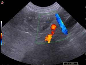 dog adrenal doppler