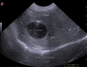 dog gallbladder ultrasound