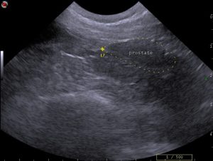 dog prostate ultrasound