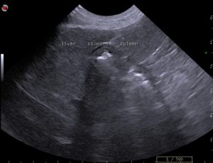 comparison spleen liver