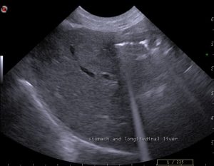 dog liver ultrasound