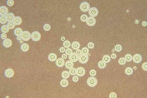 cryptococcus neoformans yeast