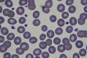 blood cells platelets